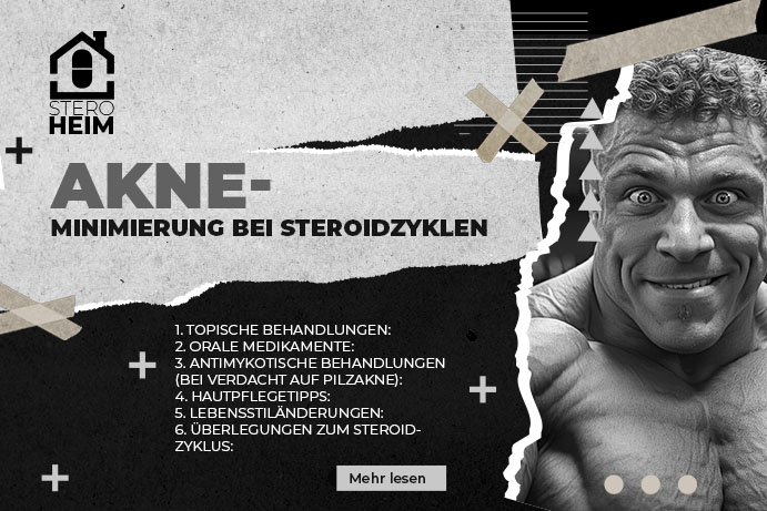 27. STRATEGIEN ZUR MINIMIERUNG VON AKNE WAêHREND STEROIDZYKLEN EINSCHLIESSLICH MEDIKAMENTE UND DOSIERUNGEN